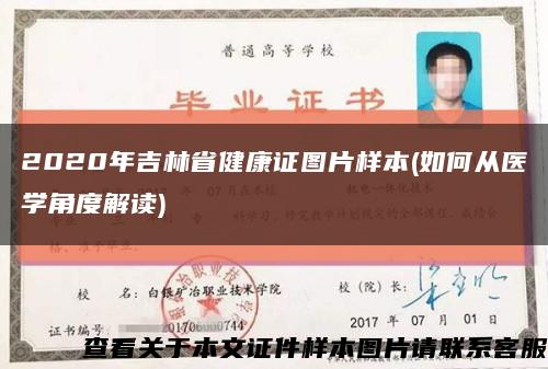 2020年吉林省健康证图片样本(如何从医学角度解读)缩略图