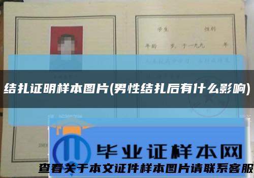 结扎证明样本图片(男性结扎后有什么影响)缩略图