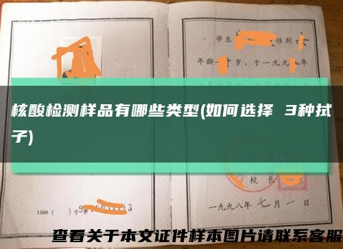 核酸检测样品有哪些类型(如何选择 3种拭子)缩略图