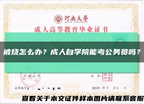 被烧怎么办？成人自学院能考公务员吗？缩略图