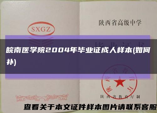 皖南医学院2004年毕业证成人样本(如何补)缩略图