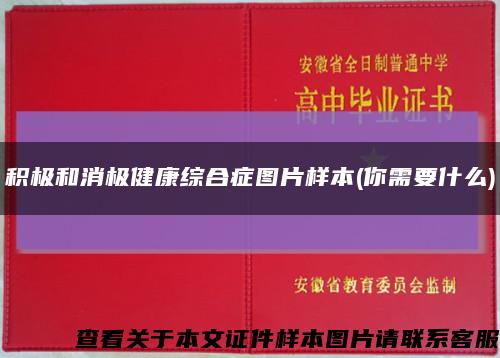积极和消极健康综合症图片样本(你需要什么)缩略图