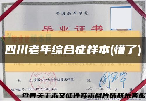 四川老年综合症样本(懂了)缩略图