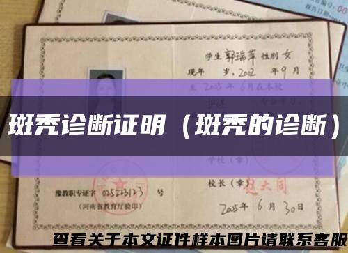 斑秃诊断证明（斑秃的诊断）缩略图